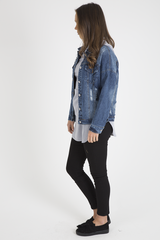 Dark Wash Distressed Denim Jacket - Madison-Jackets